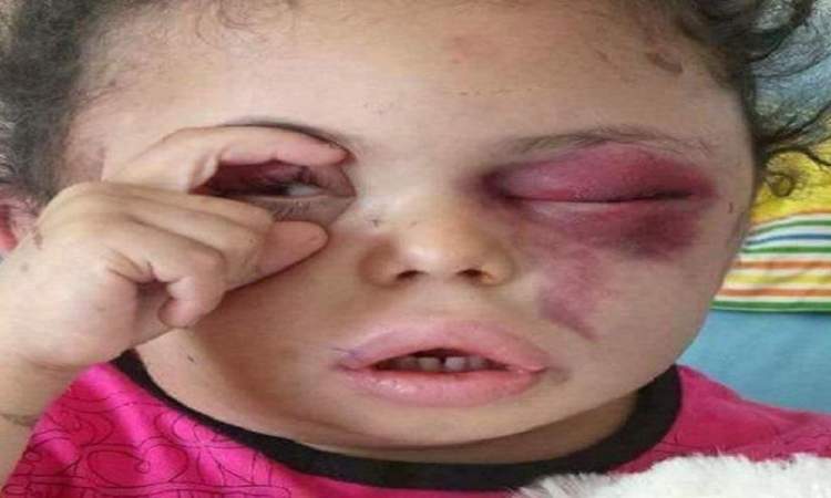 صنعاء.. الإعدام لخاطفين الطفلة بثينة في ميدان السبعين