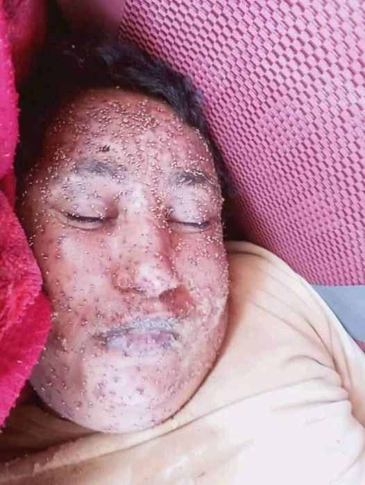 تحذيرات من الاقتراب من خلايا النحل خلال هذه الفترة عقب قتلها شابا في إب